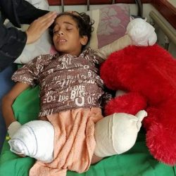 إصابة اثنين من المواطنين بنجران إثر سقوط مقذوفات أطلقتها عناصر حوثية من داخل اليمن