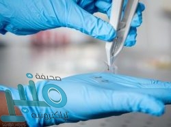 منها علاج الإمساك.. تعرف على الفوائد الصحية لشرب الماء الدافئ