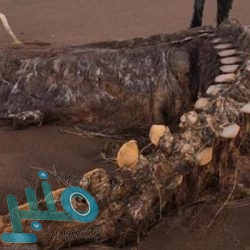 ما هي آلام البطن التي تُلزمك بمراجعة الطبيب؟.. توضيح من مختصين