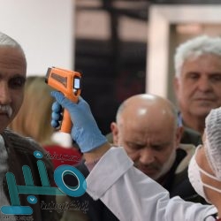 أسباب كثرة النوم اضرابات فى الغدة الدرقية أو زيادة هرمونات