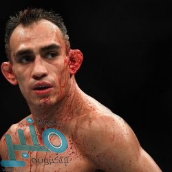 شرطة القصيم تلقي القبض على مواطن يتظاهر بشرب محلول لمادةٍ منظفةٍ