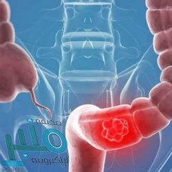 الأرصاد: رياح نشطة مثيرة للأتربة والغبار تتحول إلى عاصفة ترابية على 4 مناطق