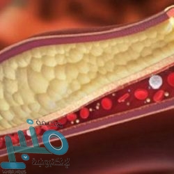 مدني المدينة المنورة: النار والأدخنة في كهف أم الجرسان سببها مخلفات حيوانية مطمورة