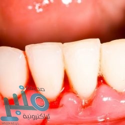 أبل تكشف السر وراء تصميم سماعات AirPods اللاسلكية