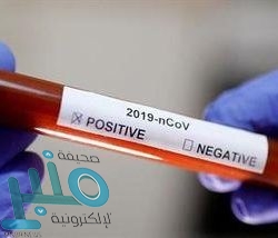 “الصحة العالمية” رداً على طبيبين إيطاليين : فيروس “كورونا” سيُعد منتهيا في حالة واحدة فقط