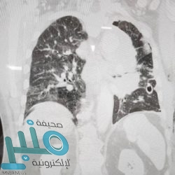 “الغذاء والدواء” تحذر من استهلاك مياه معبأة تزيد نسبة “البرومات” فيها عن الحد الأقصى