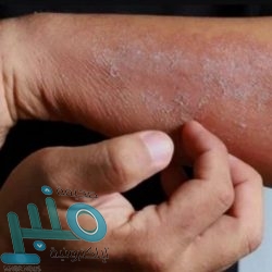 احذر.. تطبيقات على «آيفون» تكلفك أموالاً ضخمة