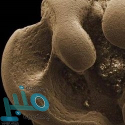 4 عوامل تؤدي إلى تساقط الشعر.. تعرّف عليها