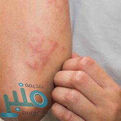 تتحول لغازات سامة تُدمر الرئة.. تحذير من خطأ شائع عند استخدام «مواد التنظيف»