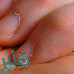 السمك قد يحمي أدمغة النساء الأكبر سناً من الآثار الضارة لتلوث الهواء