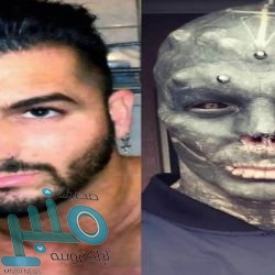 شاهد.. خبير فيروسات: كورونا أصبح أكثر شراسة بعد تعرضه لطفرة جينية