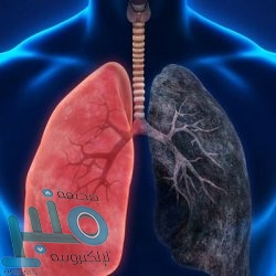 رونالدو ينقذ يوفنتوس من الهزيمة أمام روما