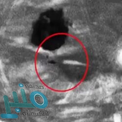 مركز الملك سلمان للإغاثة يوقع اتفاقية مشتركة لتنفيذ مشروع توفير الحقيبة المدرسية لأطفال السودان