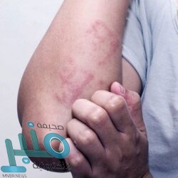 برشلونة يواجه أزمة دفاعية جديدة