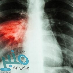 علماء يكتشفون عضوا جديدا غامضا في حلق الإنسان