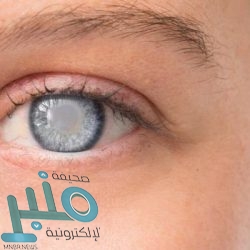 اكتشاف عيوب في كاميرا “Galaxy Note 20 Ultra”