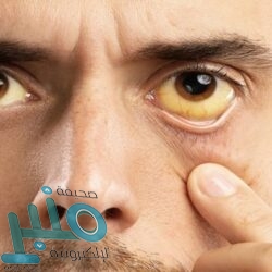 “الصحة المغربية” تحسم الجدل بشأن سفر فريق الرجاء لمواجهة الزمالك