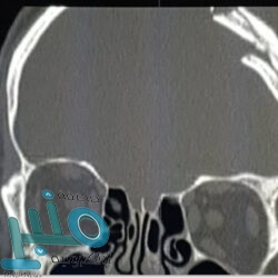 شفاعة أمير الشرقية تنهي قضية قـتل في الدمام بتنازل ولي الـدم عن الجاني
