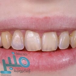 “سامسونغ” تفاجئ مستخدميها بترقية مهمة في سلسلة Galaxy S21