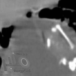 أفضل 7 أطعمة ومشروبات لتنقية الجسم من السموم