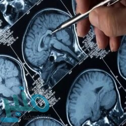 الكشف عن الملامح الأولى لتصميم الكمبيوتر المحمول “NOKIA PUREBOOK”