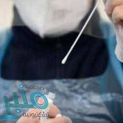 يوفنتوس يتخطى ساسولو بصعوبة.. ورونالدو “حاسم”