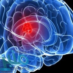 ابتكار غشاء لامتصاص العرق وتحويله لطاقة شحن‎