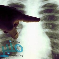 “يورو 2020”.. تغيير جذري محتمل في خطة البطولة المؤجلة