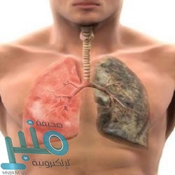 الإصابة تحرم ليفاندوفسكي من مباراتي بايرن ميونخ ضد باريس سان جيرمان