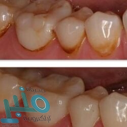 ريمونتادا بيكيه.. برشلونة إلى نهائي الكأس بعد مباراة مجنونة