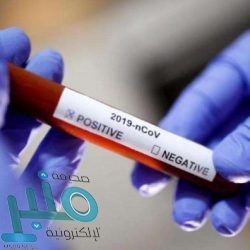 «الصحة»: إقبال عالٍ جدًا على مراكز اللقاح.. وإعطاء 130 ألف جرعة في يوم