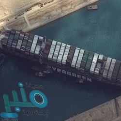 مركز الملك سلمان للإغاثة يقدم خدمات صحية متنوعة في اليمن