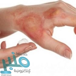 الأرصاد: أمطار رعدية مصحوبة برياح نشطة وزخات من البرد على هذه المناطق