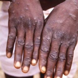 “عقارات الدولة” تتواصل مع المتضررين من إزالة الأحياء العشوائية بجدة لتعويضهم