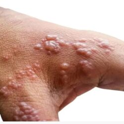 مدرب الأهلي المصري يكشف سبب خسارة فريقه لقب دوري الأبطال لصالح الوداد