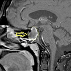 مركز التحكيم الرياضي يرد على الطعن المقدم من الهلال في قضية “كنو”