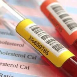 شركة أدوية تخسر 15 مليار دولار بعد تغريدة من حساب مزيف اشترى العلامة الزرقاء بـ 8