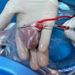 مشروع المملكة للإفادة من الهدي والأضاحي يوزع 12 ألف ذبيحة في قطاع غزة