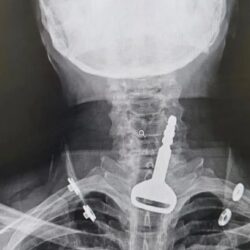 تدخل سريع ينقذ حاجّة ستينية توقف قلبها