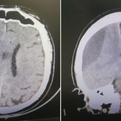 الخارجية تستدعي القائمة بأعمال سفارة الدنمارك على خلفية حرق نسخة من القرآن وتسلمها مذكرة احتجاج
