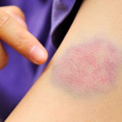 صحة مكة تصدر 14 مخالفة لعيادات أسنان خاصة بالمنطقة