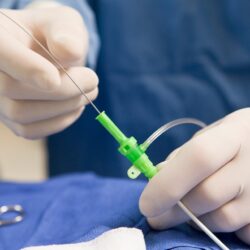 الإرشاد الزراعي: ينصح المزارعين بعدم زراعة أشجار المانجو في المناطق التي ترتفع فيها الرطوبة والأمطار