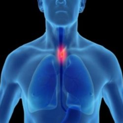 العقود الآجلة للذهب تصعد لمستوى قياسي