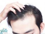 4 عوامل تؤدي إلى تساقط الشعر.. تعرّف عليها