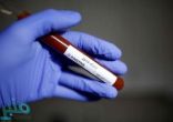 “الفيروس القاتل” يحصد الأرواح ويخلف إصابات جديدة في عددٍ من الدول العربية