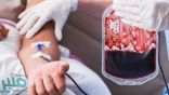 فقر الدم.. أنواعه والأسباب وطرق العلاج