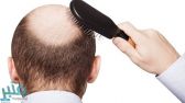 7 علاجات منزلية طبيعية لوقف تساقط الشعر