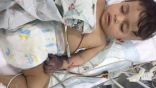 الأمير محمد بن سلمان بن عبدالعزيز يتكفل بعلاج الطفل “جسار”