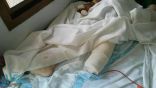 إصابة طفلتين يمنيتين في انفجار لغم حوثي بتعز