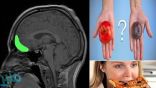 اكتشاف طريقة لبرمجة المخ والتحكم في تفضيلاته للطعام
